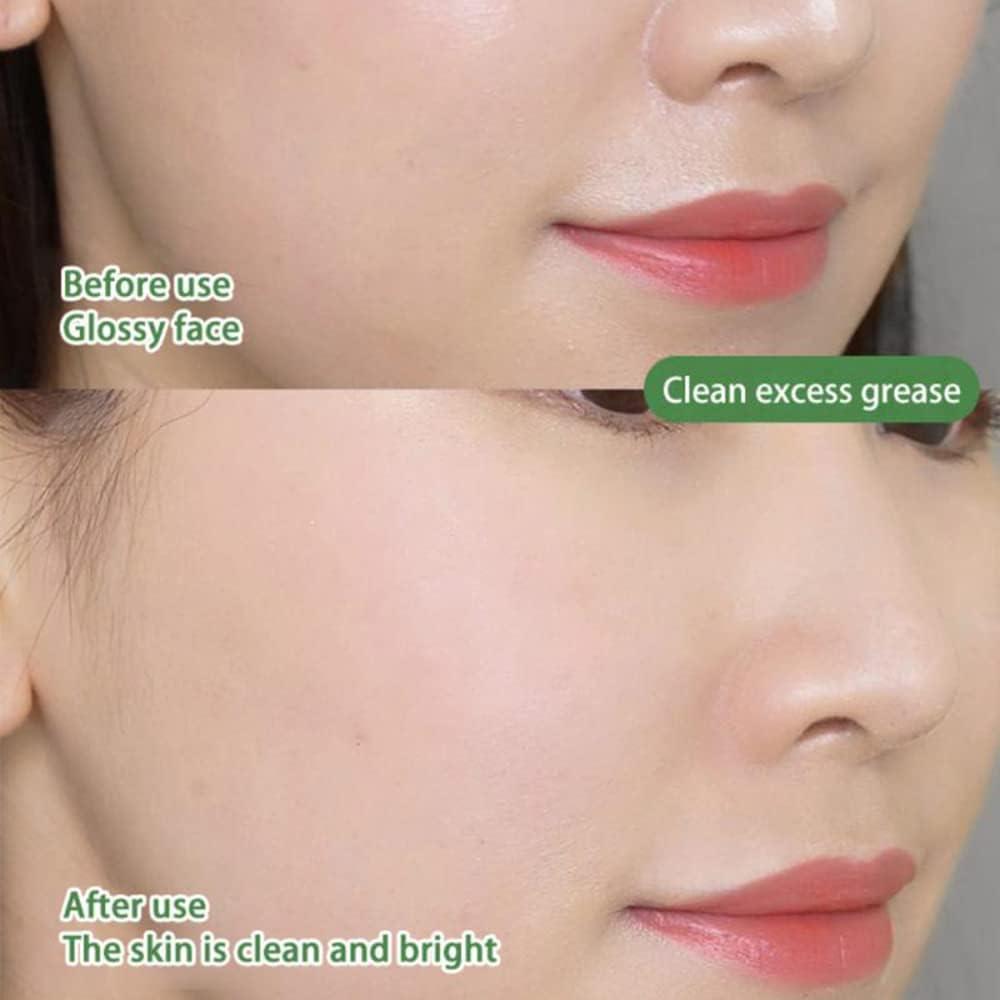 Mască pentru Curățarea Porilor și Controlul Acneei 1+1 Gratuit