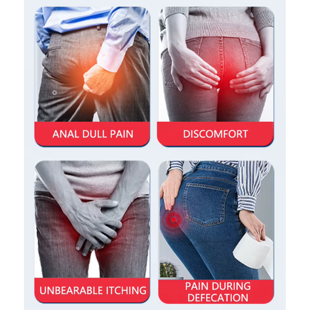 Cremă Naturală pe Bază de Plante pentru Hemoroizi și Fistule Anale 1+1 Gratuit